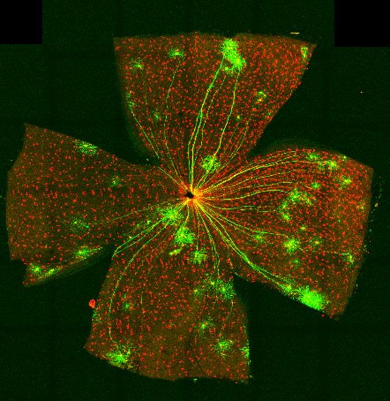 Flat-mounted mouse retina