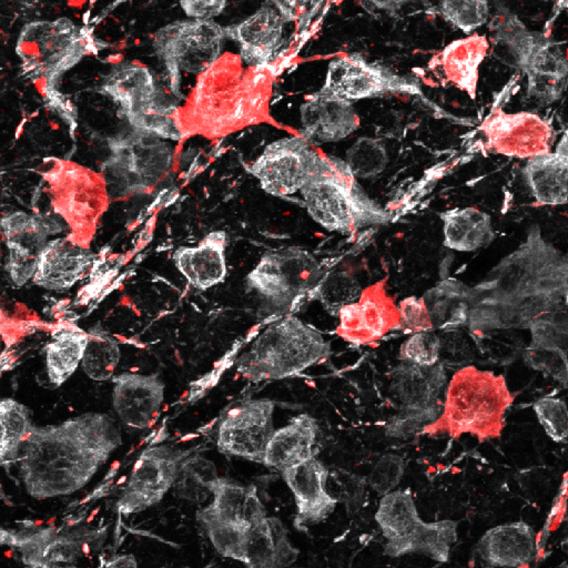 Flat-mounted mouse retina