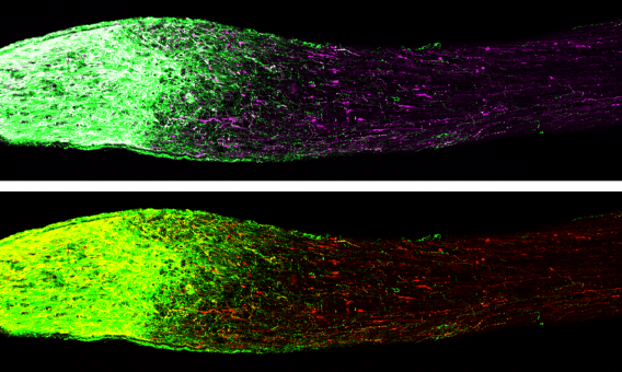 Mouse optic nerves