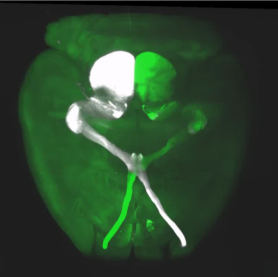 Whole mouse brain after tissue clearing