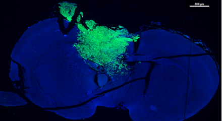 research image