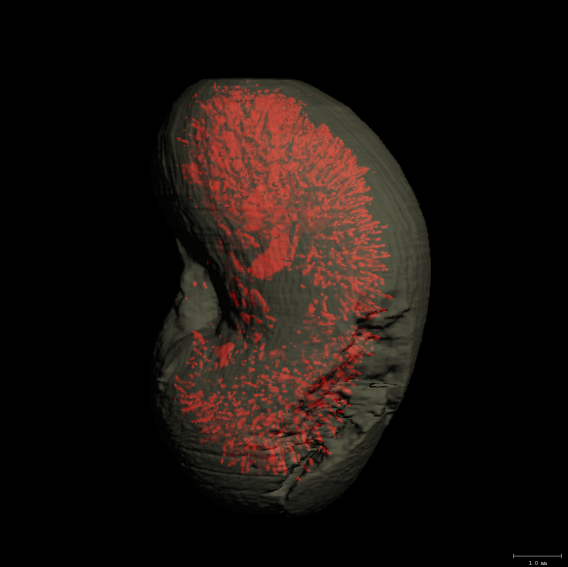 Kidney tubules highlighted within a microCT scan