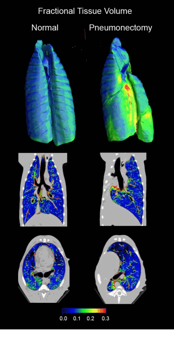 Fractional Tissue Volume