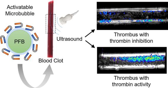 detection of acute thrombosis