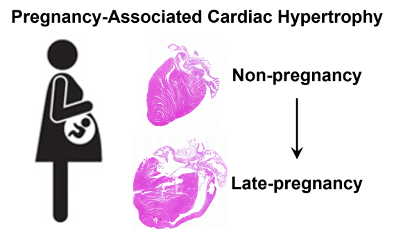 Pregnancy-associated cardiac hypertrophy