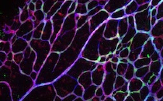 Blood Vessel Formation enlargement