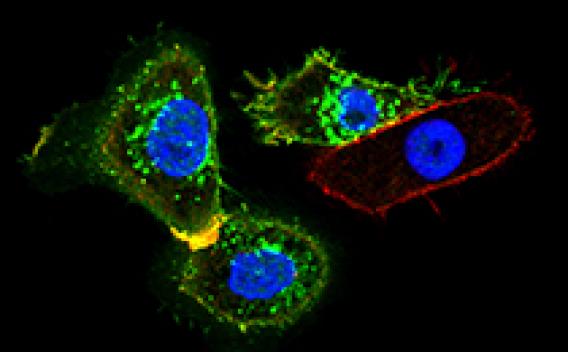 Tumors under the microscope