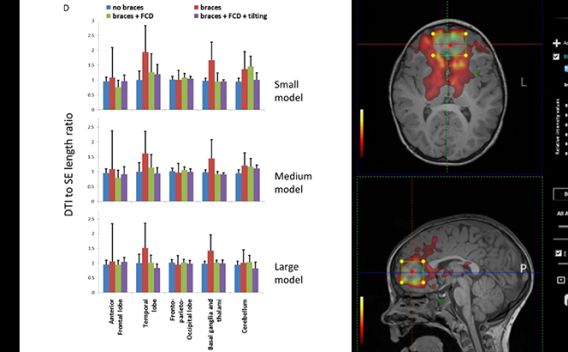 Pediatric MRI