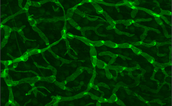 GFP-positive lymphatic vessels