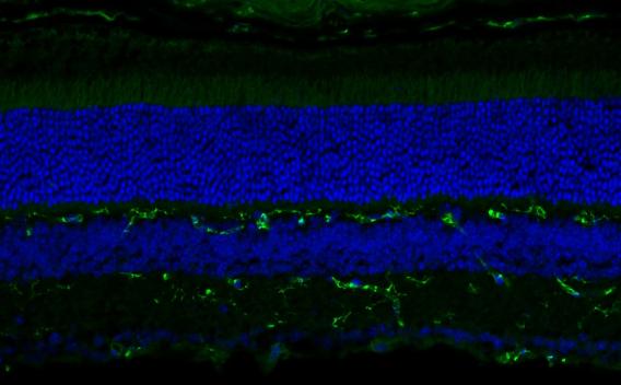 Vertical section of a mouse retina showing nuclei in blue and blood vessels in green fluorescence