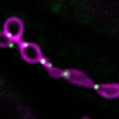 Stalled mitochondrial division without Mdi1